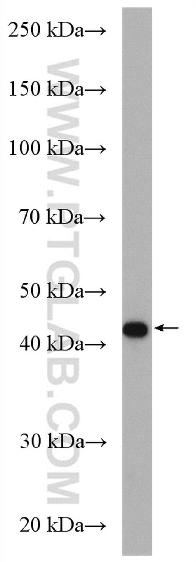 MAGT1 Antibody in Western Blot (WB)