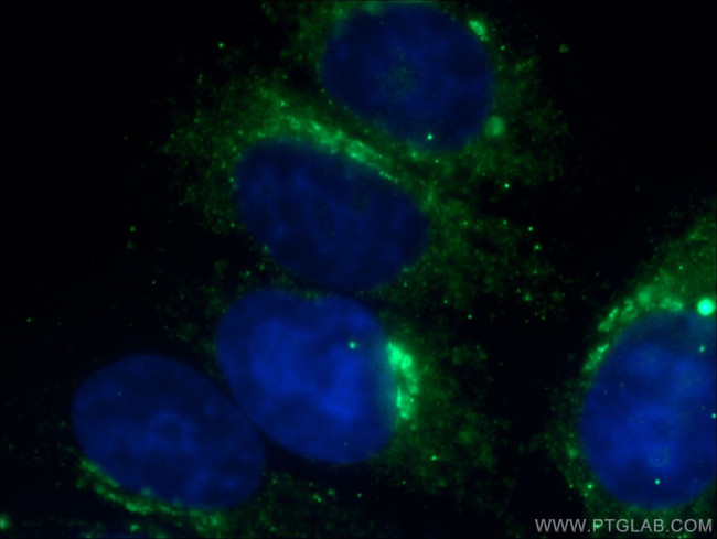 Transferrin Antibody in Immunocytochemistry (ICC/IF)