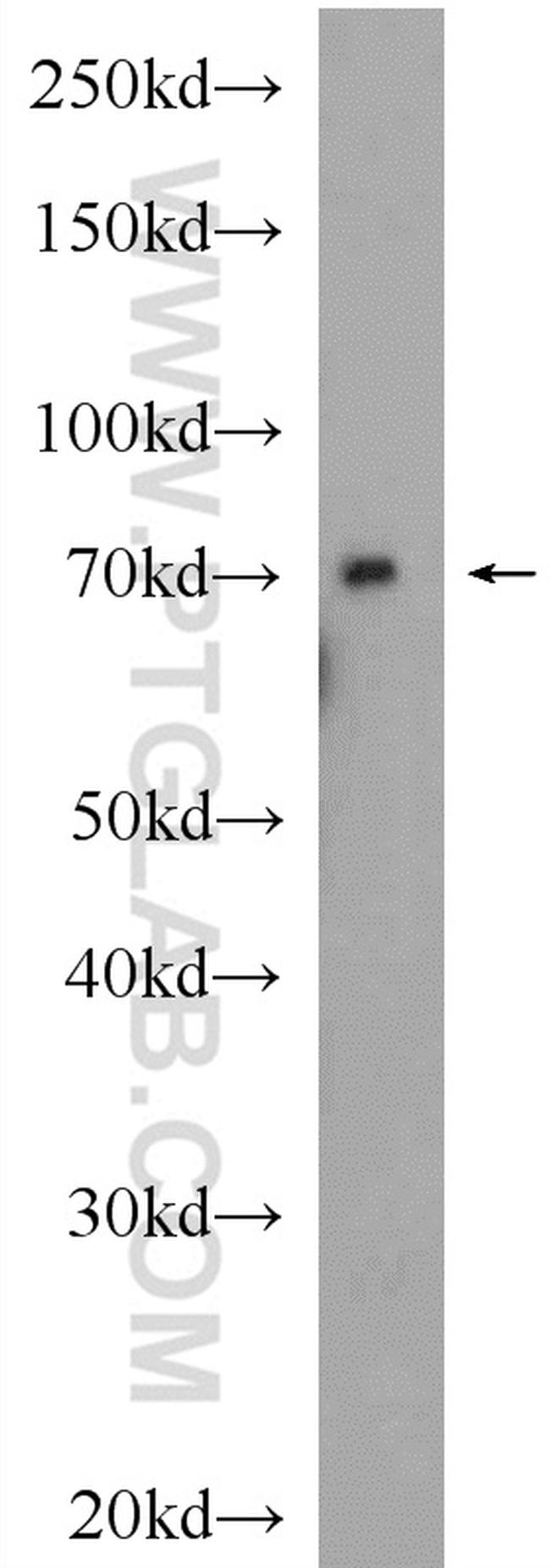 Transferrin Antibody in Western Blot (WB)