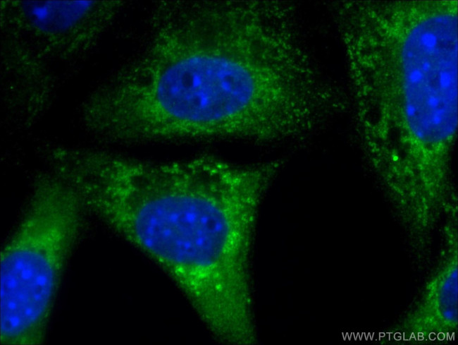 Leptin Antibody in Immunocytochemistry (ICC/IF)