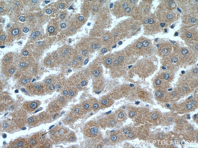 Leptin Antibody in Immunohistochemistry (Paraffin) (IHC (P))