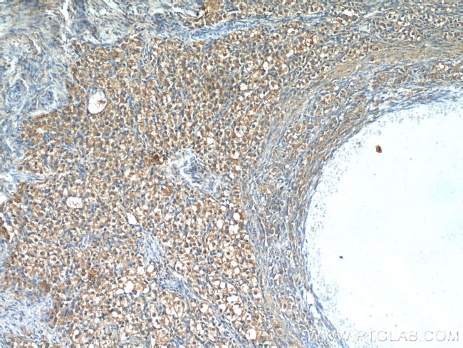 Leptin Antibody in Immunohistochemistry (Paraffin) (IHC (P))