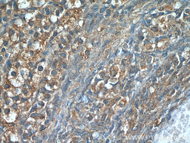 Leptin Antibody in Immunohistochemistry (Paraffin) (IHC (P))