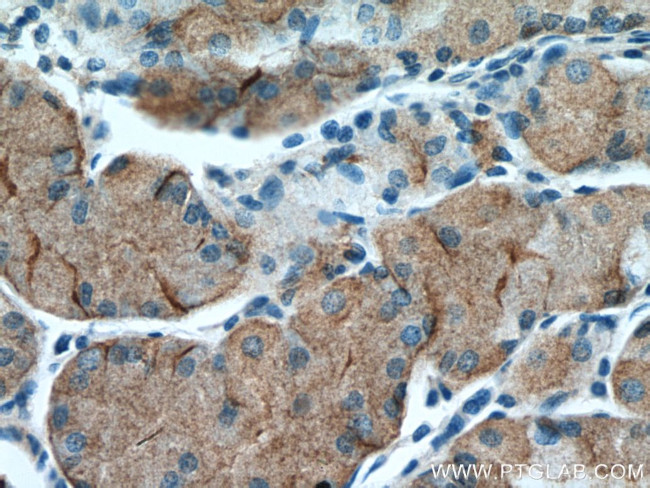 Leptin Antibody in Immunohistochemistry (Paraffin) (IHC (P))