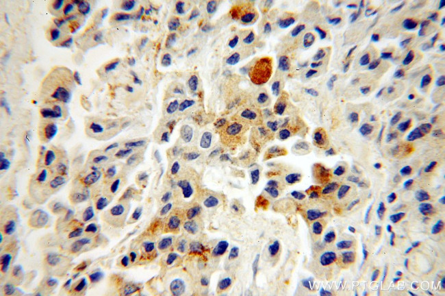 Leptin Antibody in Immunohistochemistry (Paraffin) (IHC (P))