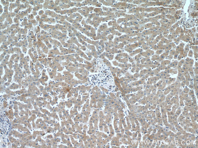 Leptin Antibody in Immunohistochemistry (Paraffin) (IHC (P))