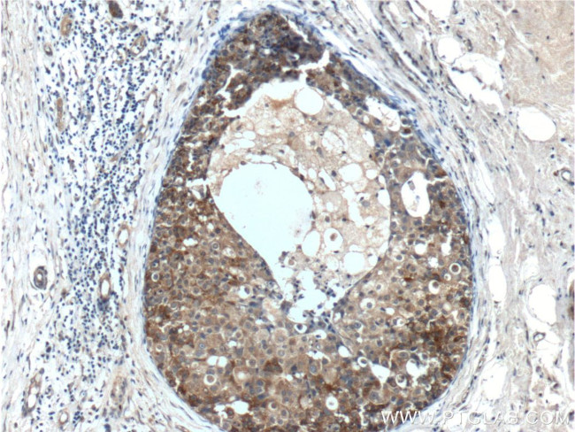 Leptin Antibody in Immunohistochemistry (Paraffin) (IHC (P))