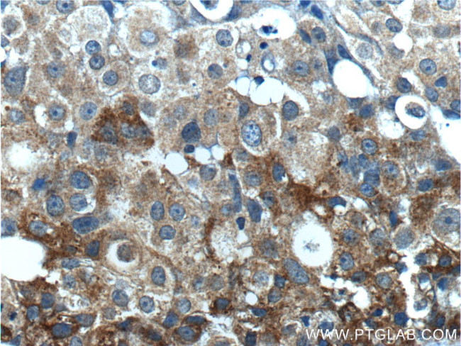 Leptin Antibody in Immunohistochemistry (Paraffin) (IHC (P))