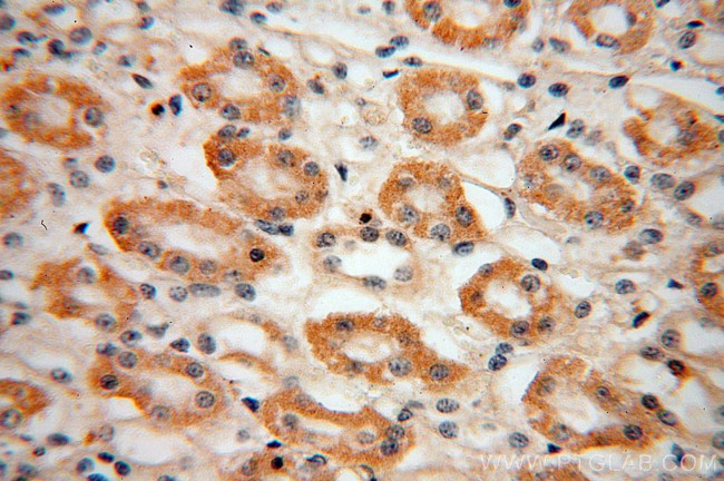 ACADL Antibody in Immunohistochemistry (Paraffin) (IHC (P))