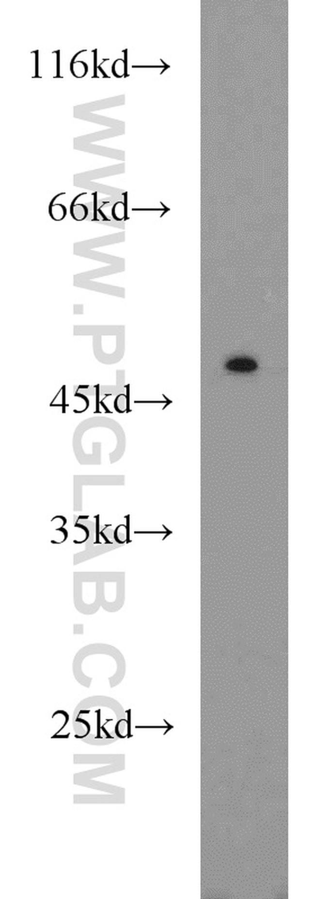 ACADL Antibody in Western Blot (WB)