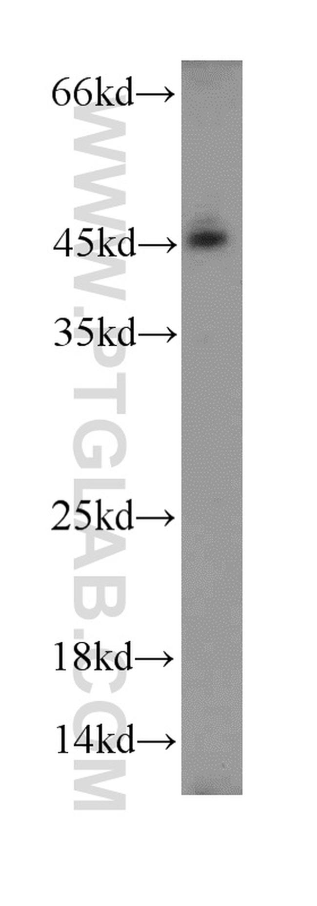 ACADL Antibody in Western Blot (WB)