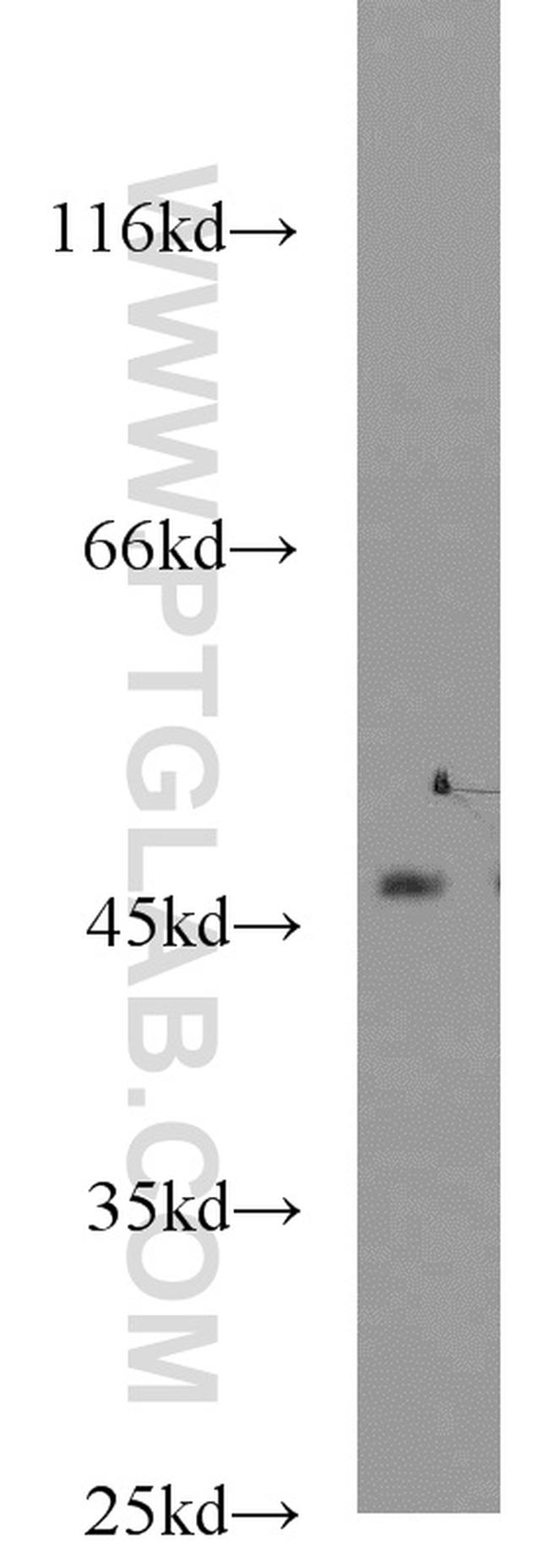 ACADL Antibody in Western Blot (WB)