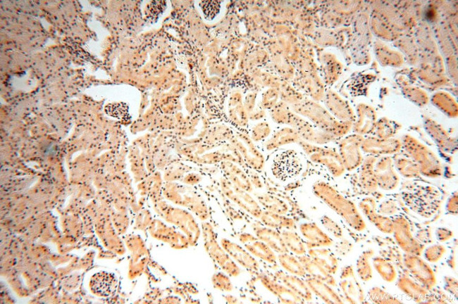 HDAC4 Antibody in Immunohistochemistry (Paraffin) (IHC (P))