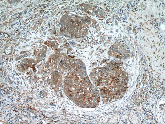 HDAC4 Antibody in Immunohistochemistry (Paraffin) (IHC (P))