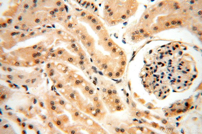 HDAC4 Antibody in Immunohistochemistry (Paraffin) (IHC (P))