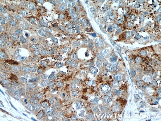 HDAC4 Antibody in Immunohistochemistry (Paraffin) (IHC (P))