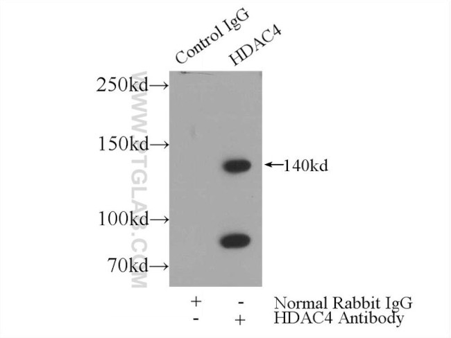 HDAC4 Antibody in Immunoprecipitation (IP)