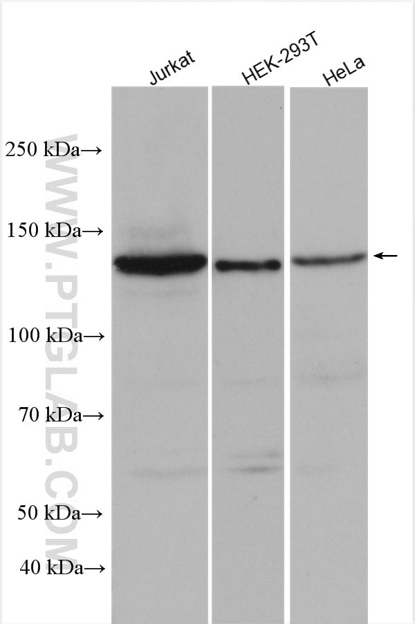 HDAC4 Antibody in Western Blot (WB)