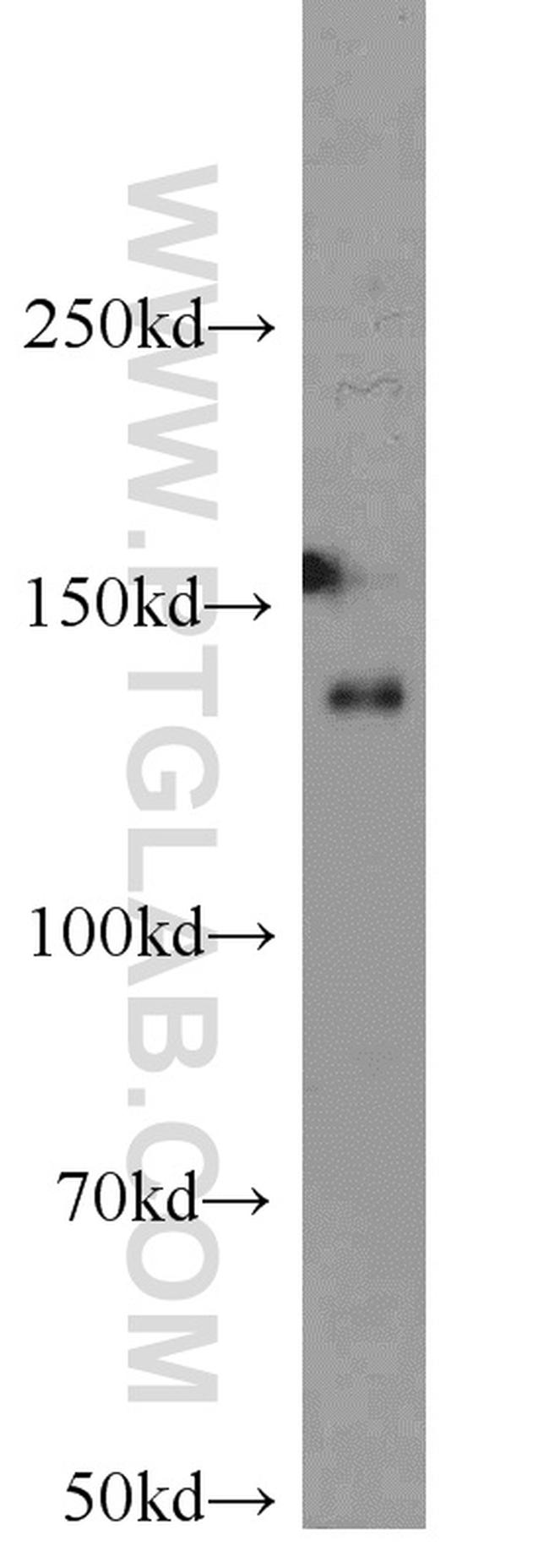 HDAC4 Antibody in Western Blot (WB)