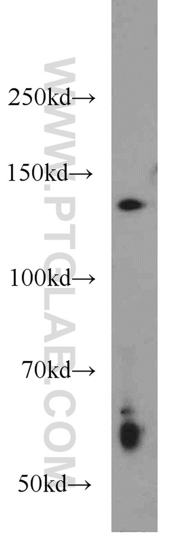 HDAC4 Antibody in Western Blot (WB)