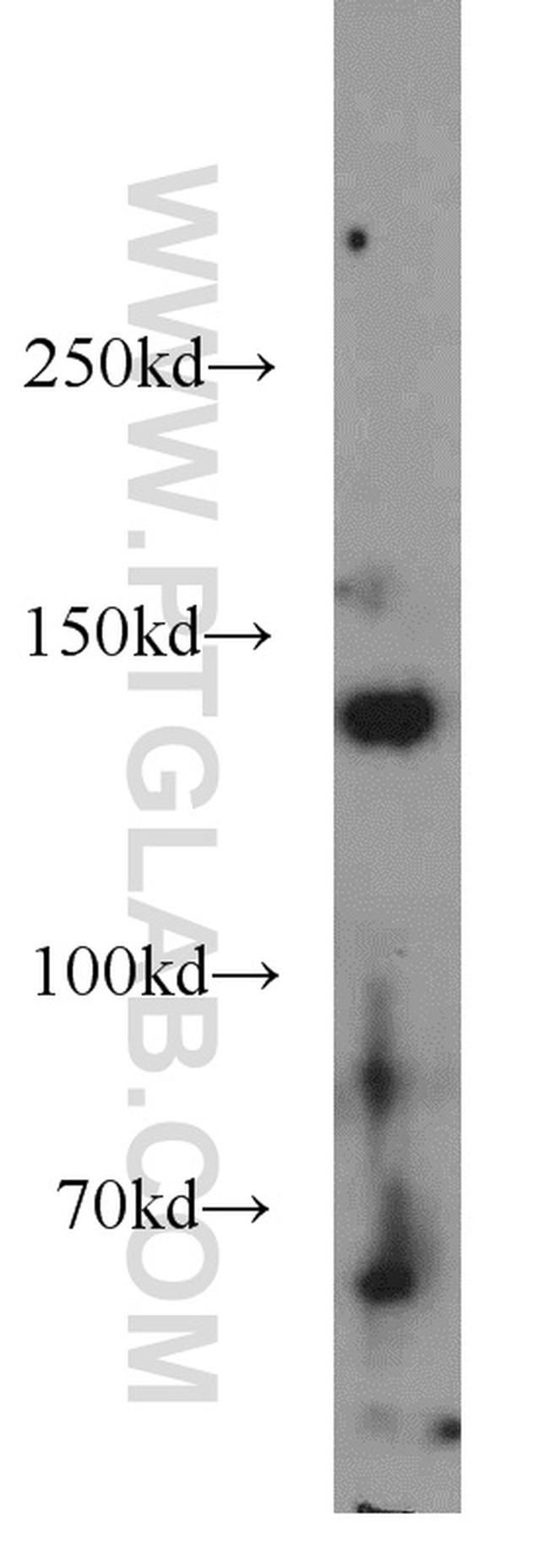 HDAC4 Antibody in Western Blot (WB)