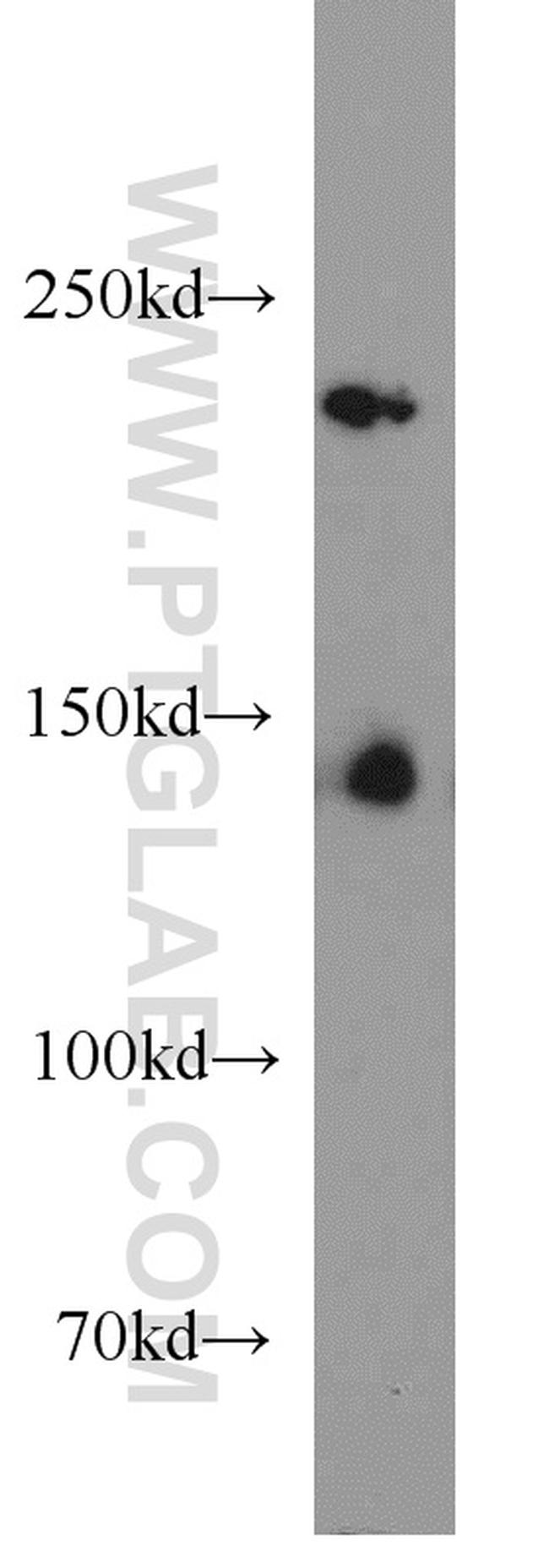 HDAC4 Antibody in Western Blot (WB)