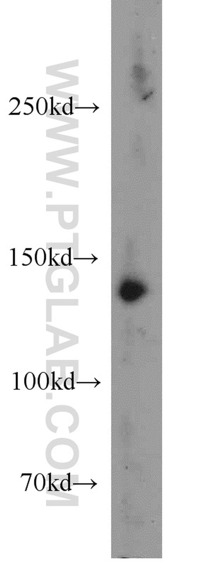 HDAC4 Antibody in Western Blot (WB)