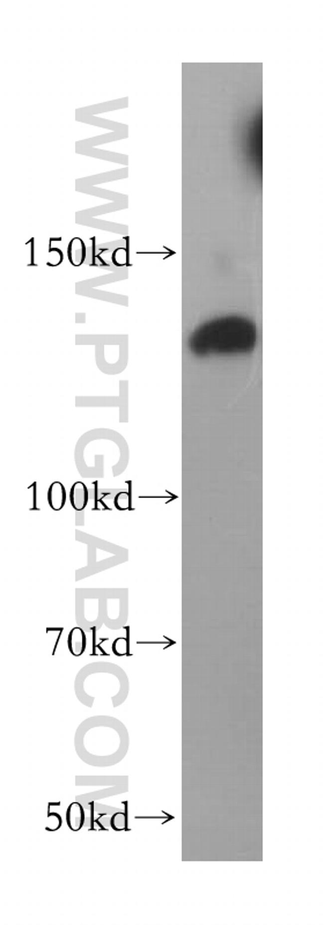 HDAC4 Antibody in Western Blot (WB)