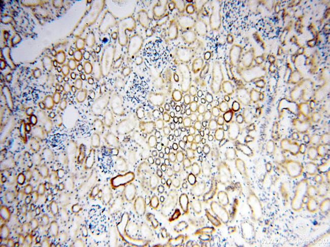 COQ5 Antibody in Immunohistochemistry (Paraffin) (IHC (P))