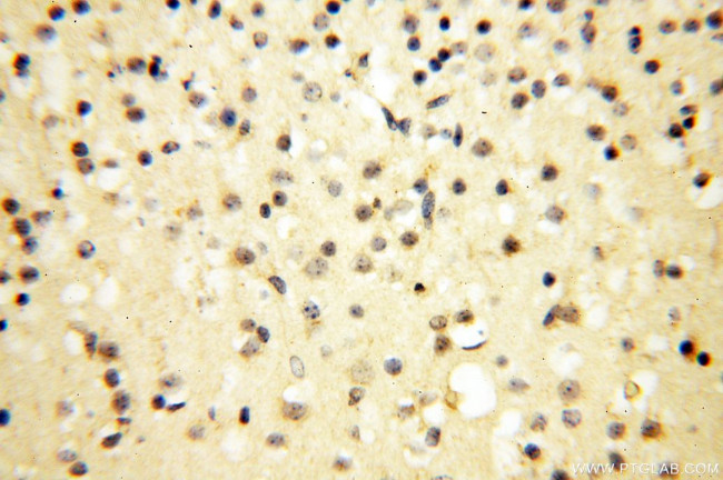 COQ5 Antibody in Immunohistochemistry (Paraffin) (IHC (P))