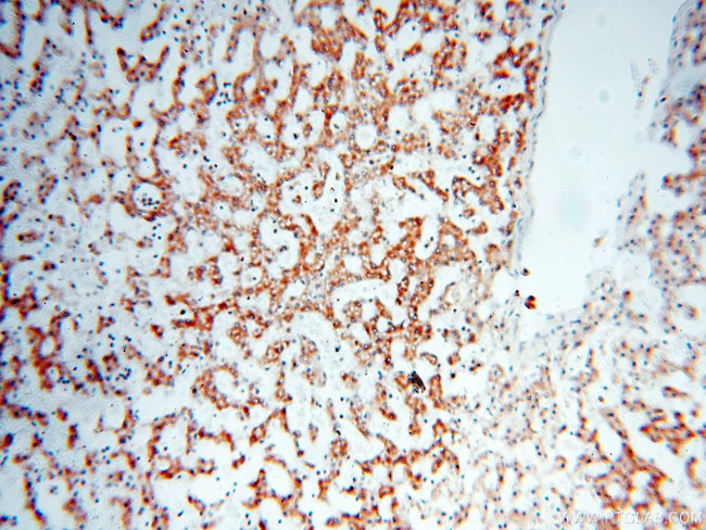 COQ5 Antibody in Immunohistochemistry (Paraffin) (IHC (P))