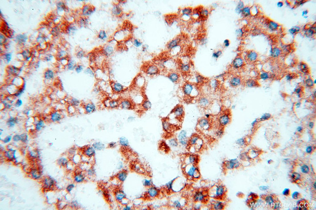 COQ5 Antibody in Immunohistochemistry (Paraffin) (IHC (P))