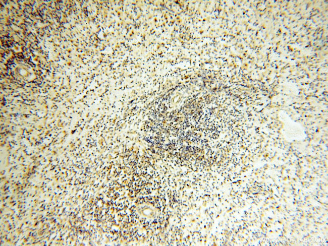 COQ5 Antibody in Immunohistochemistry (Paraffin) (IHC (P))