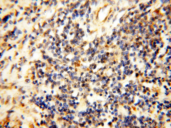 COQ5 Antibody in Immunohistochemistry (Paraffin) (IHC (P))