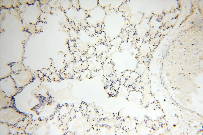 COQ5 Antibody in Immunohistochemistry (Paraffin) (IHC (P))