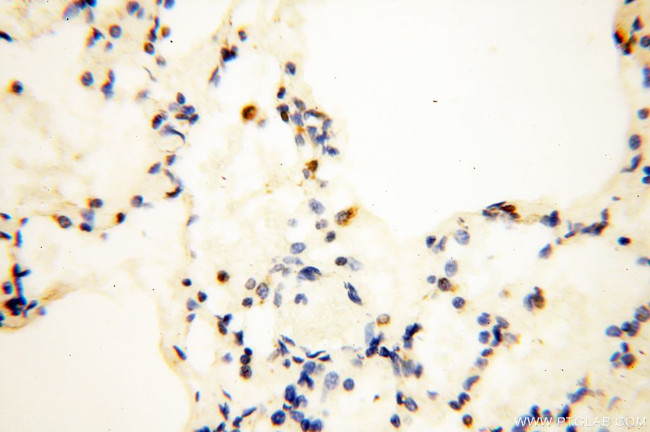 COQ5 Antibody in Immunohistochemistry (Paraffin) (IHC (P))