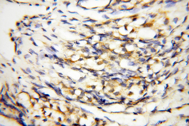 COQ5 Antibody in Immunohistochemistry (Paraffin) (IHC (P))