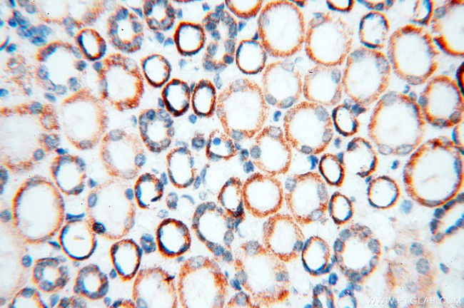 COQ5 Antibody in Immunohistochemistry (Paraffin) (IHC (P))