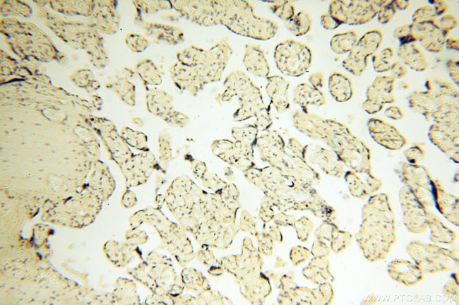 COQ5 Antibody in Immunohistochemistry (Paraffin) (IHC (P))