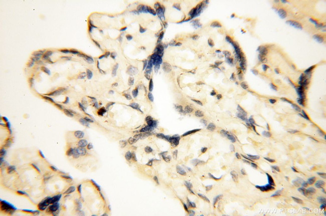 COQ5 Antibody in Immunohistochemistry (Paraffin) (IHC (P))