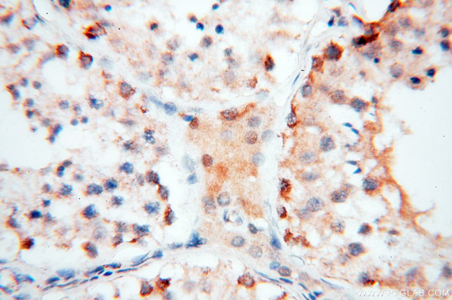 COQ5 Antibody in Immunohistochemistry (Paraffin) (IHC (P))