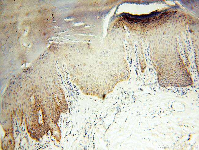 COQ5 Antibody in Immunohistochemistry (Paraffin) (IHC (P))