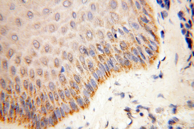 COQ5 Antibody in Immunohistochemistry (Paraffin) (IHC (P))