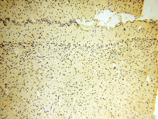 COQ5 Antibody in Immunohistochemistry (Paraffin) (IHC (P))