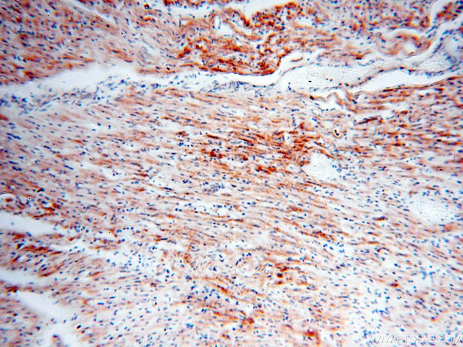 COQ5 Antibody in Immunohistochemistry (Paraffin) (IHC (P))