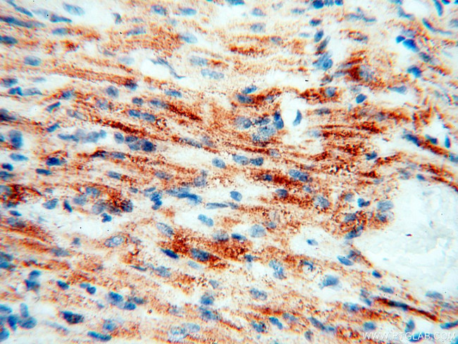 COQ5 Antibody in Immunohistochemistry (Paraffin) (IHC (P))