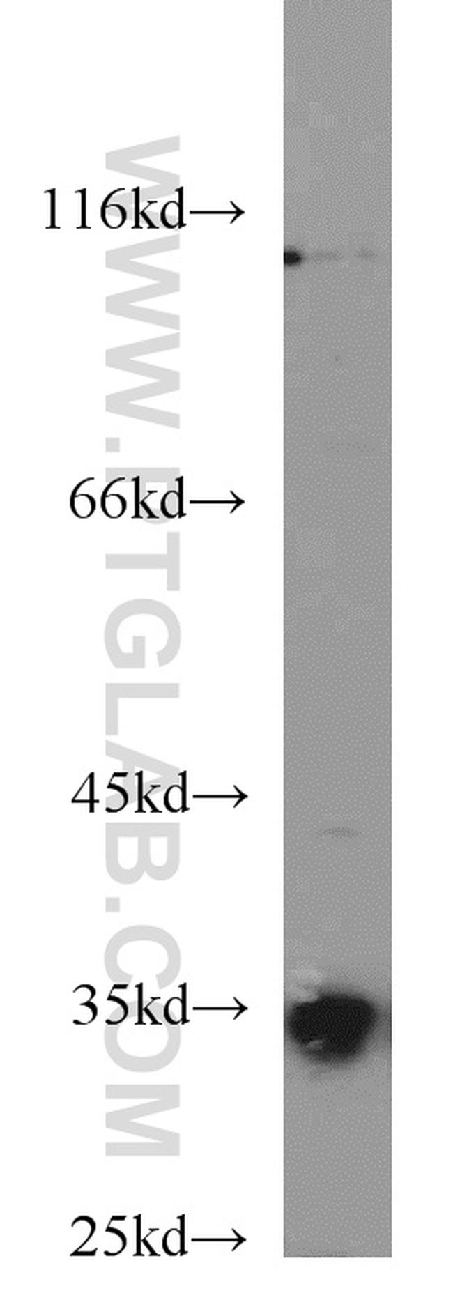 COQ5 Antibody in Western Blot (WB)