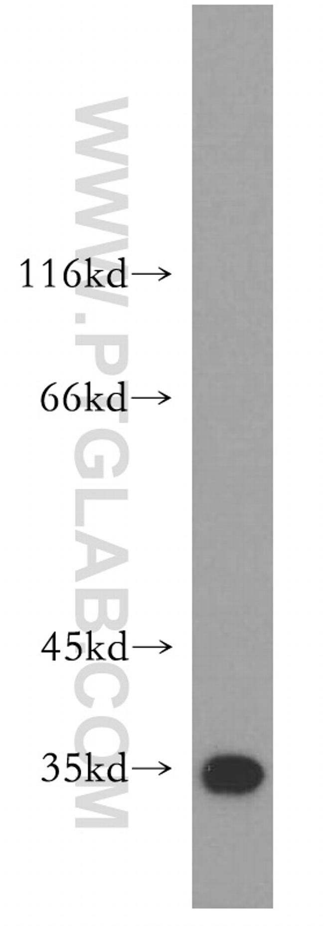 COQ5 Antibody in Western Blot (WB)