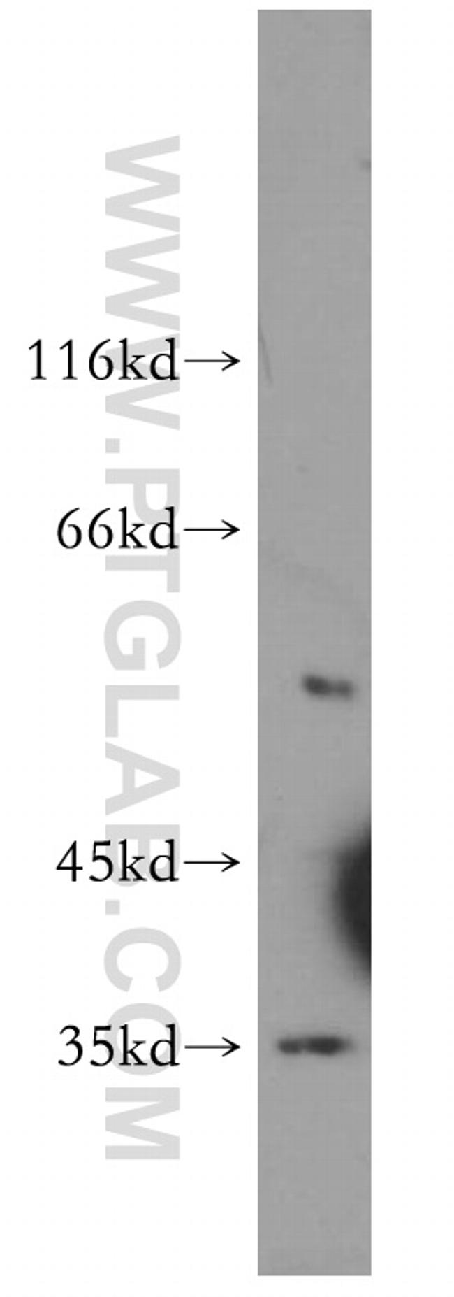 COQ5 Antibody in Western Blot (WB)