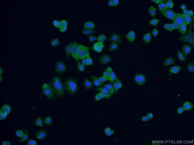 FABP7 Antibody in Immunocytochemistry (ICC/IF)